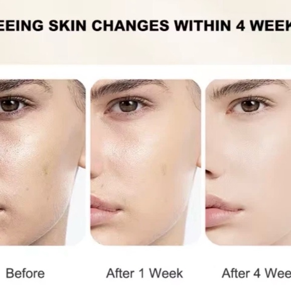 Anti-Aging Concentrated Vitamin C Face Serum Moisturizing Brightener (set of 2) - Picture 6 of 6